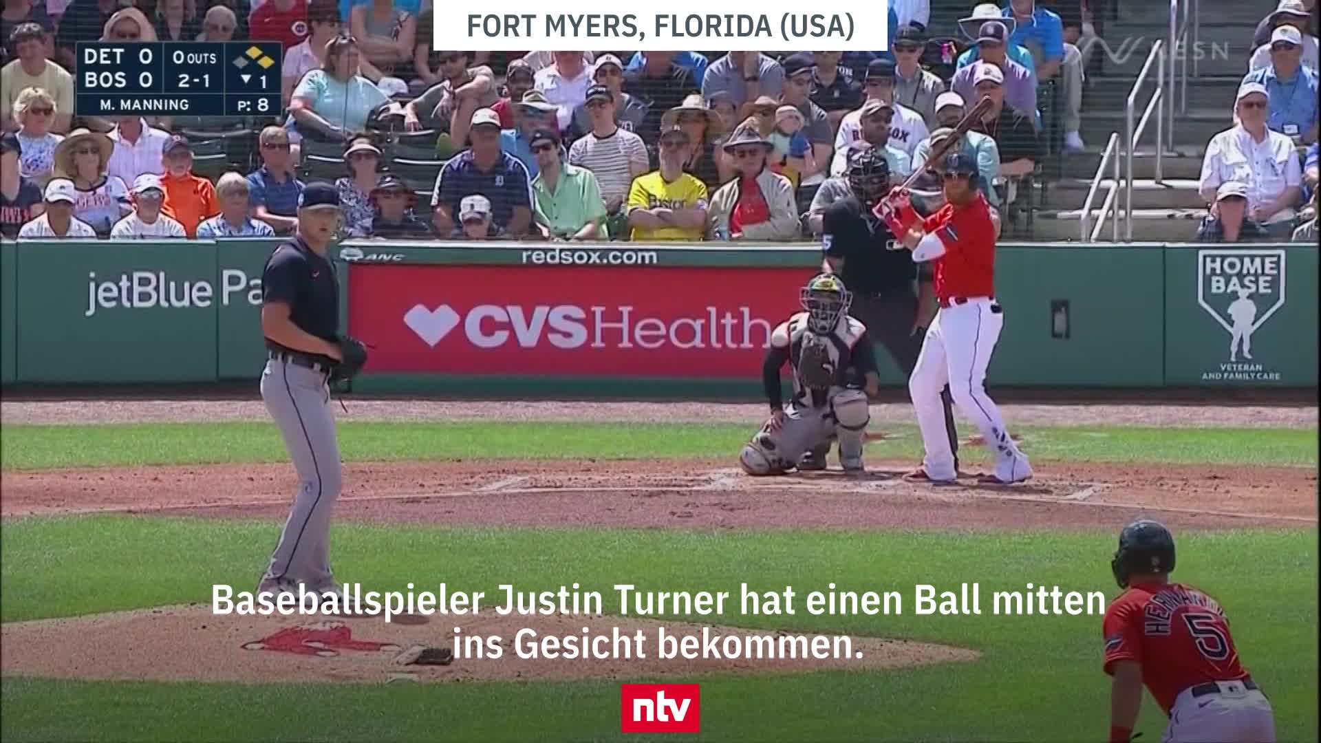 Fieser Gesichtstreffer in der MLB