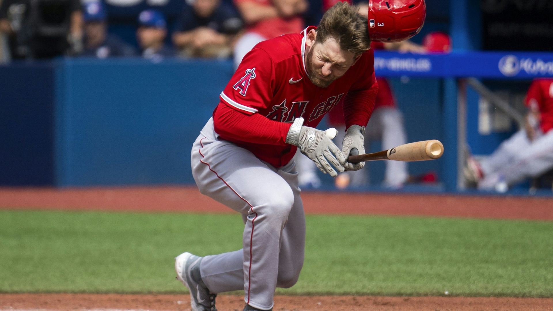 MLB-Profi Taylor Ward erleidet Gesichtsfrakturen